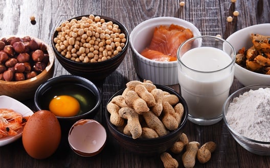 Foods that some people may be allergic to, including shellfish, eggs, nuts, milk and more