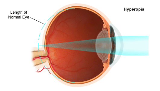 vision diagram