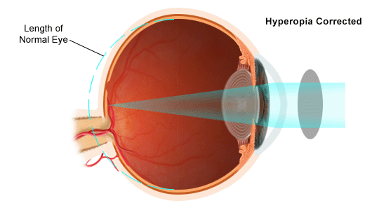 vision diagram