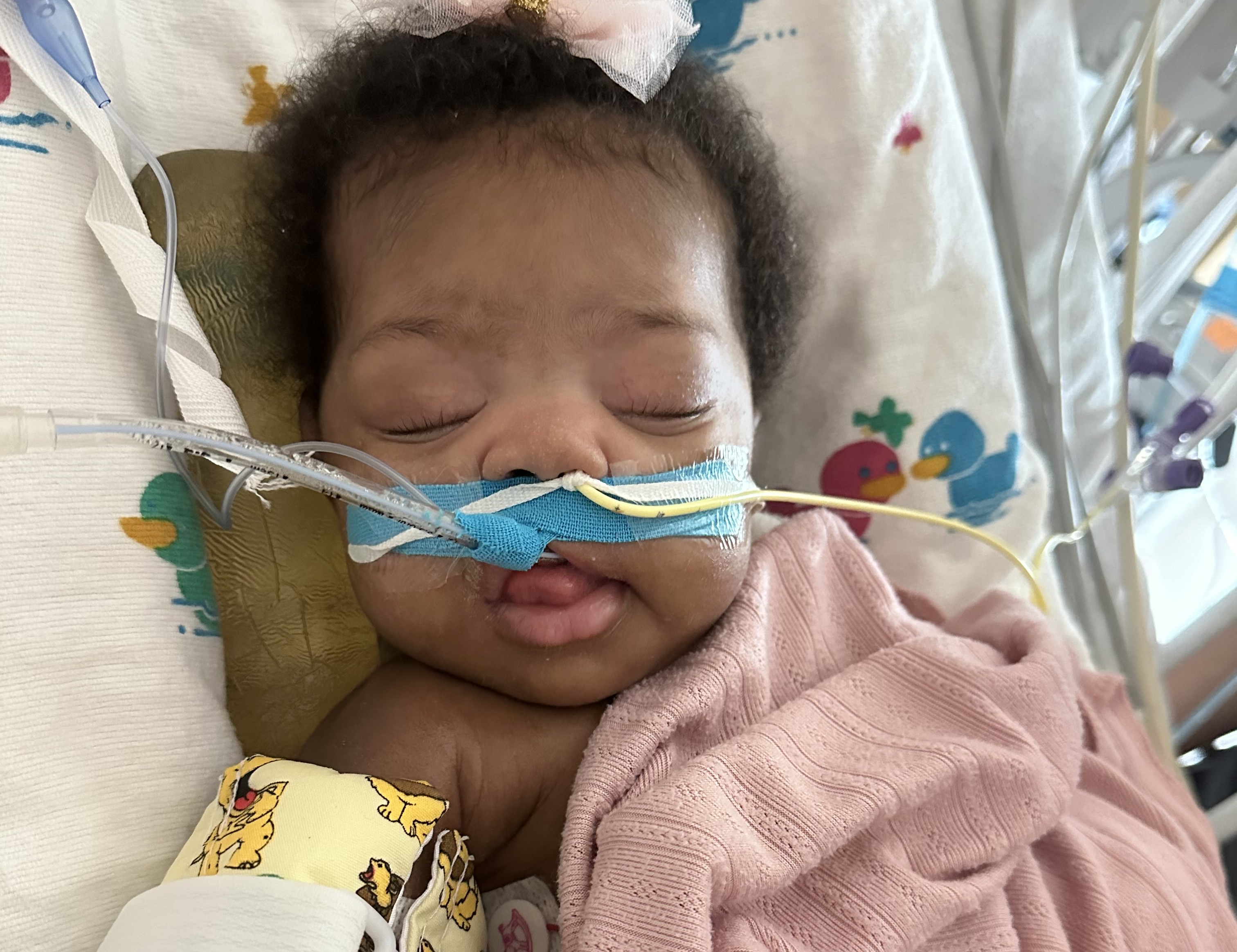 Melaina as an infant receiving supplemental oxygen.