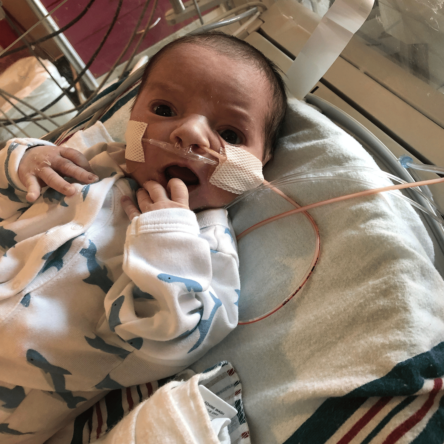Baby with a oxygen tubes
